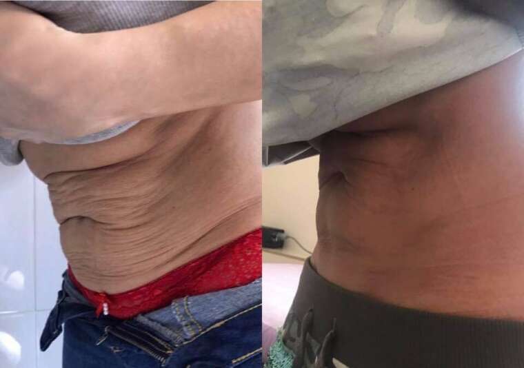 HH