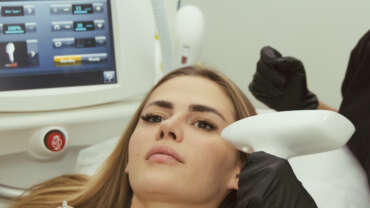 Acne Scar Treatment