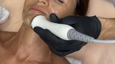 Cryotherapy