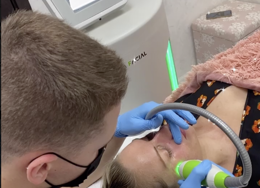 Cryolevate: Cryo Lifting Ulevate