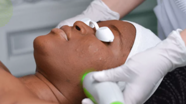 Facial Oxygen Therapy – Ulevate