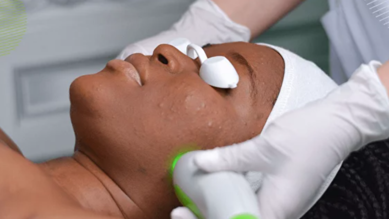 Facial Oxygen Therapy – Ulevate