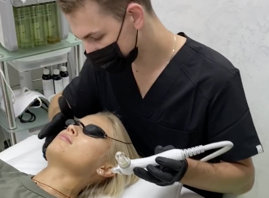 Oxygen peeling VivaPeel