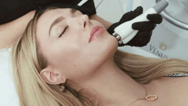 Skin Tightening