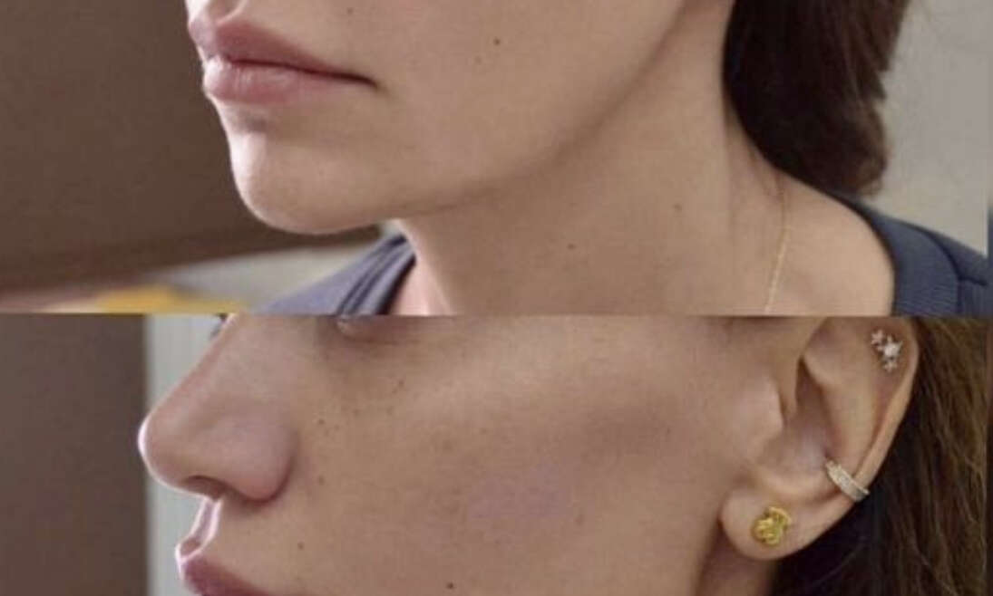 FACIAL SCULPTING: THE ART OF YOUR FACE CONTOURING