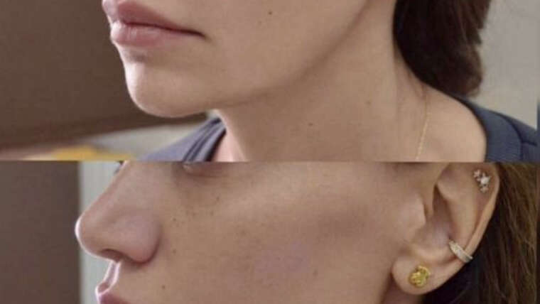 FACIAL SCULPTING: THE ART OF YOUR FACE CONTOURING