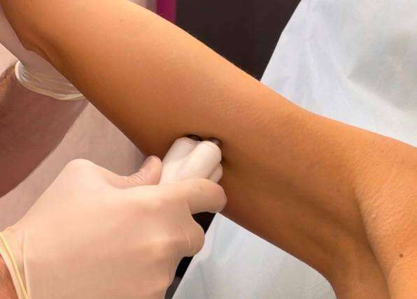 How to Tighten Arm Skin