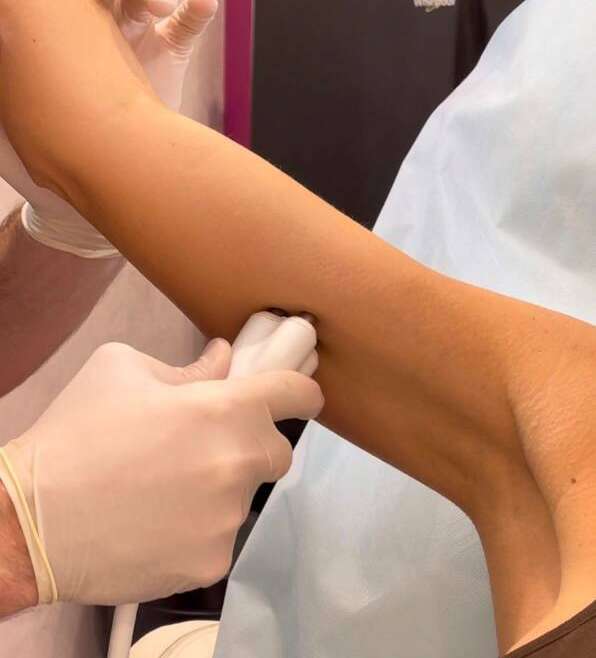 How to Tighten Arm Skin